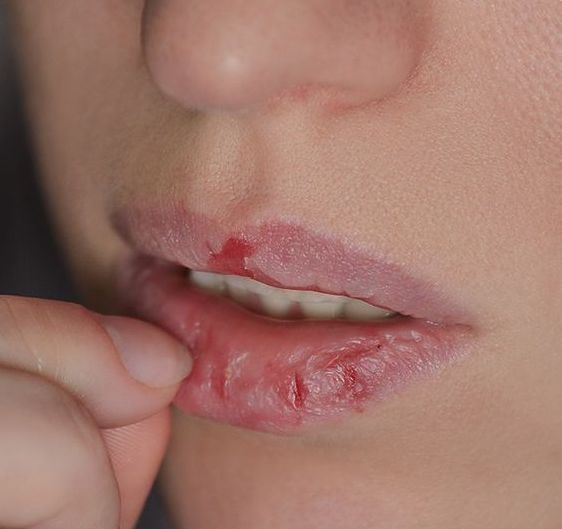 【護唇秘訣】 吃這些還原粉嫩嘴唇!打擊「黑嘴唇」杜絕3大壞習慣