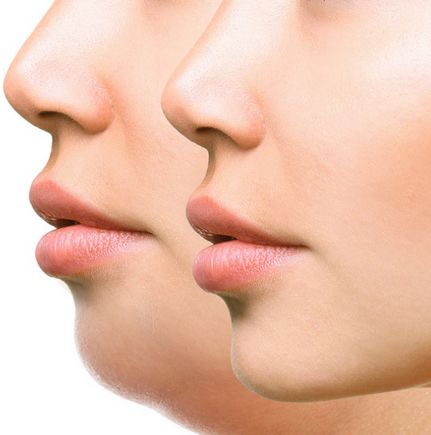 雙下巴的成因唔一定係肥胖!跟著6個簡單動作 擺脫頑固雙下巴