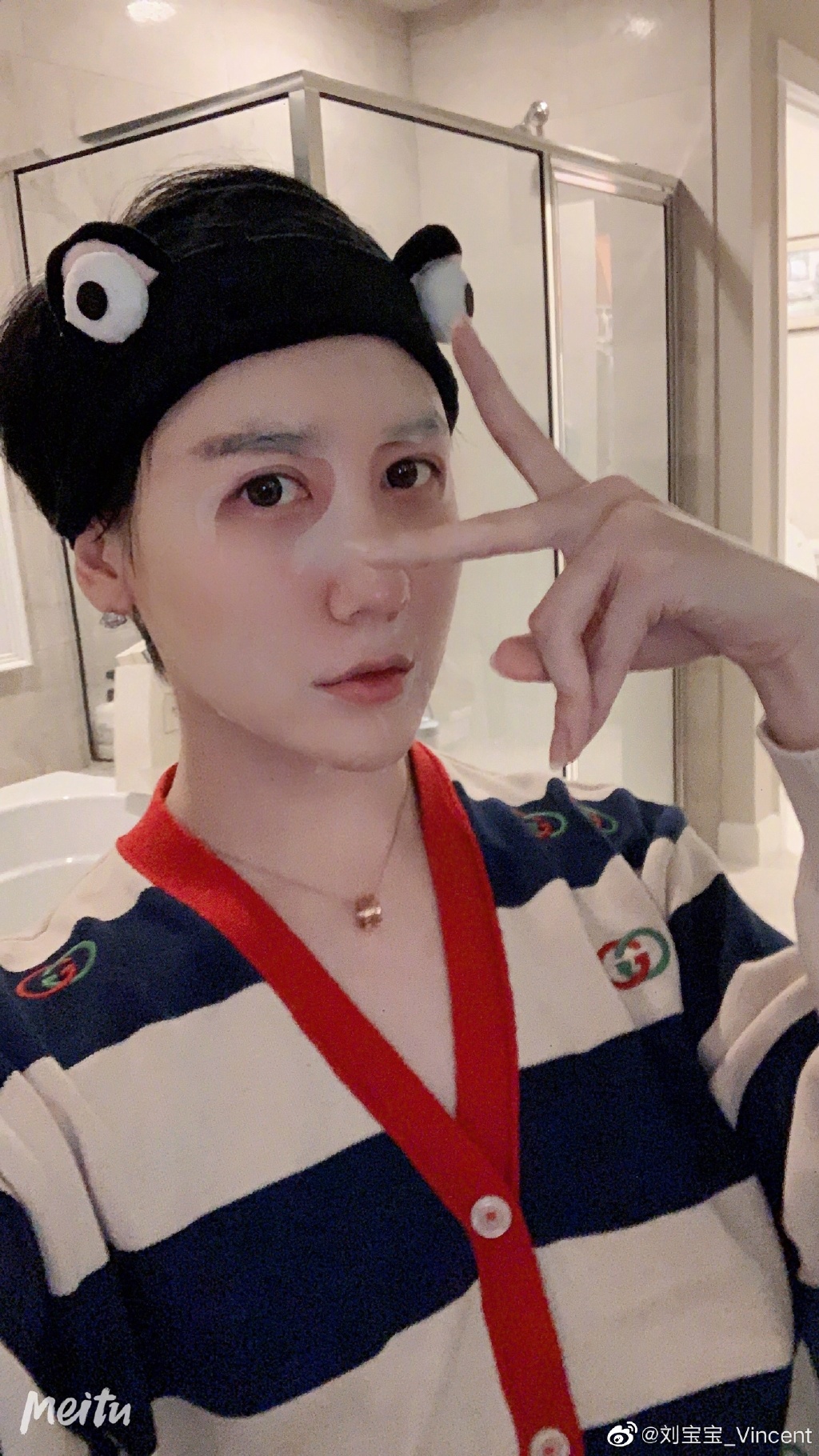 「蛇精男」劉梓晨滿臉又紅又腫痘痘 痛哭經歷著痛苦生活