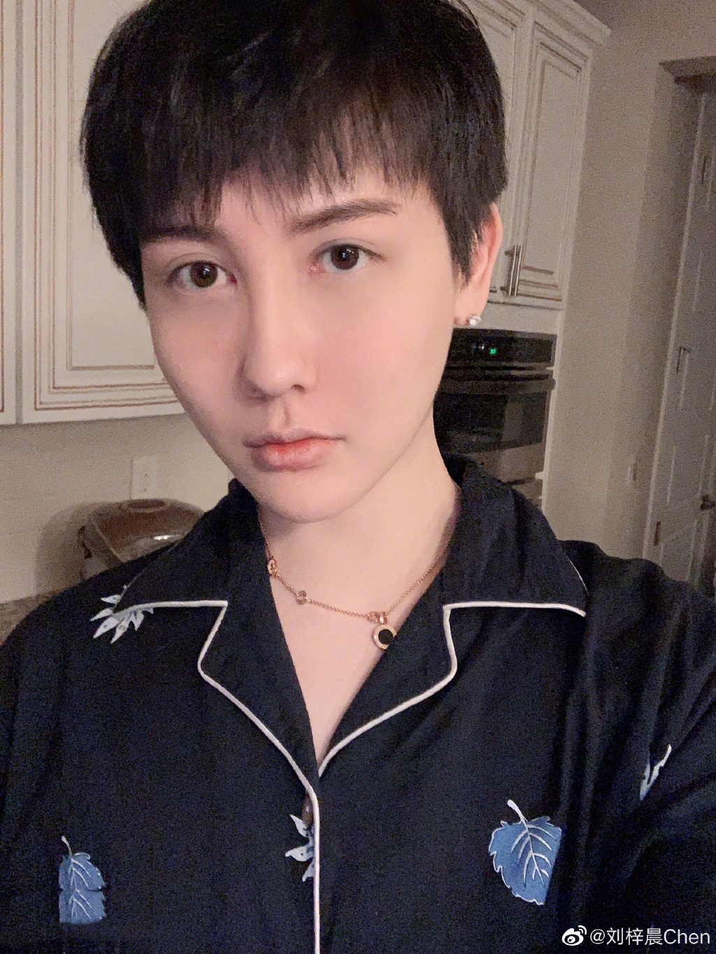 「蛇精男」劉梓晨滿臉又紅又腫痘痘 痛哭經歷著痛苦生活