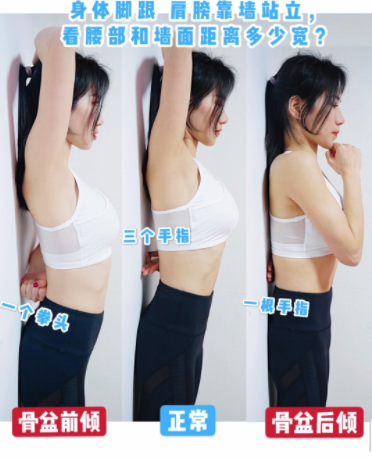 前凸後翹是假象 3招運動正盆骨