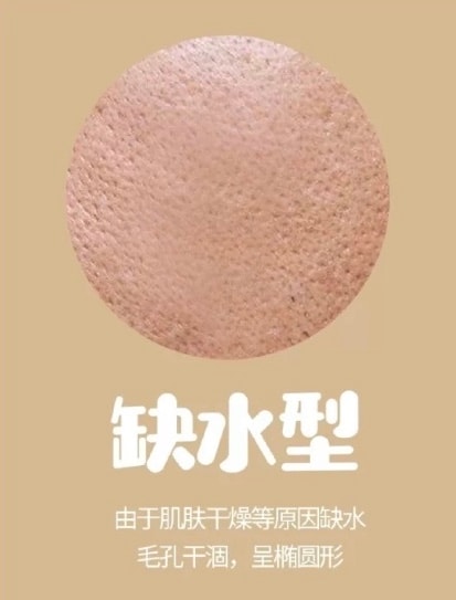 缺水型