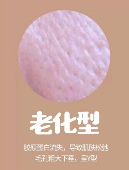 老化型