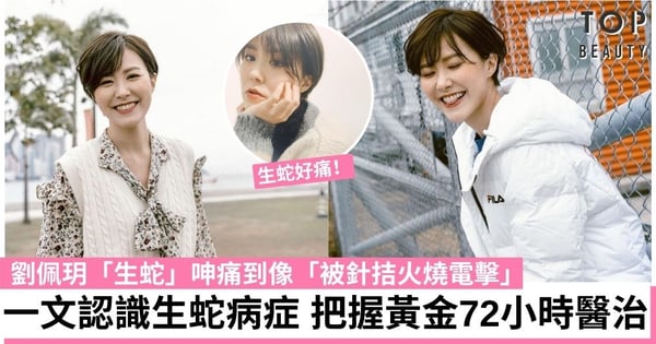 【劉佩玥生蛇】生蛇不會致命但須在72小時之內醫治！一文看清6個生蛇須注意事項