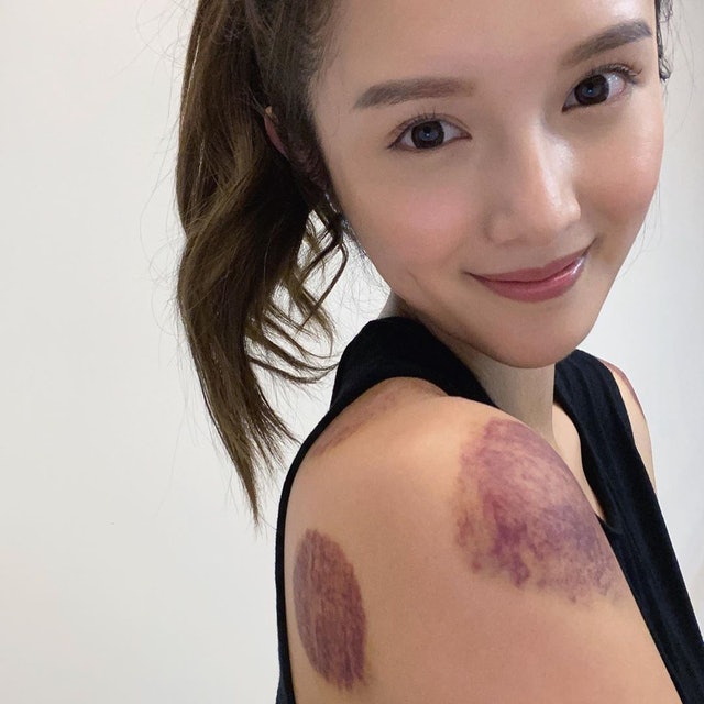 鄺潔楹為角色全身傷