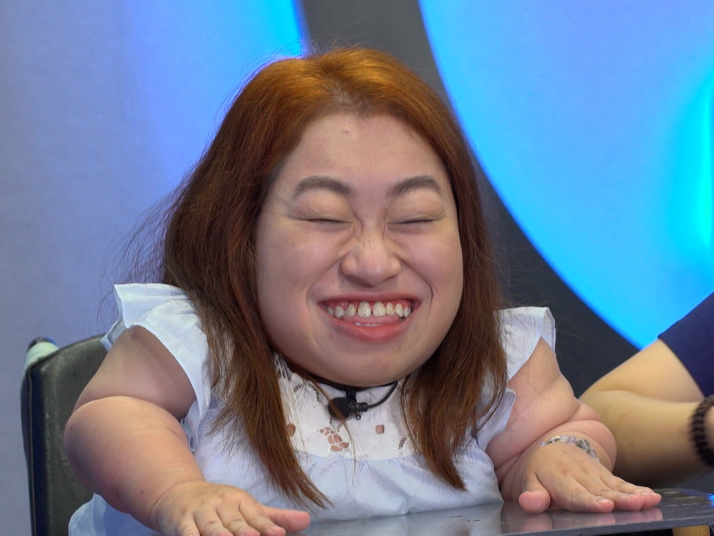 玻璃骨女孩斌琳希望見到偶像Ian陳卓賢