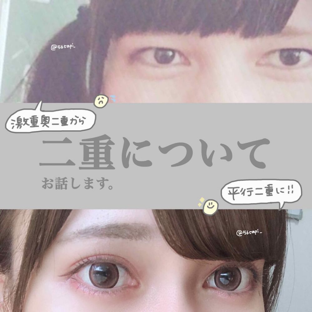 日本女生分享自己由厚重內雙變成雙眼皮的經驗