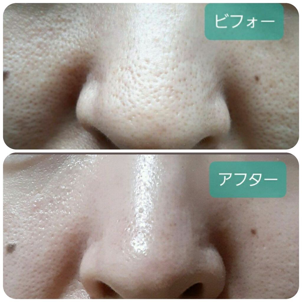 網友實測使用MUJI可可巴油後鼻子變白滑