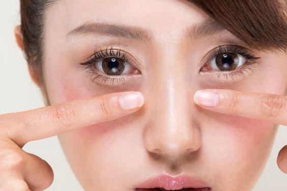選用遮瑕產品則要視你的黑眼圈顏色。