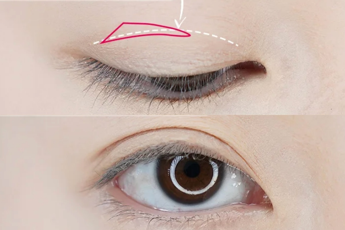 眼尾下垂也就是俗稱的無辜眼會讓整體妝容看起來不夠精神
