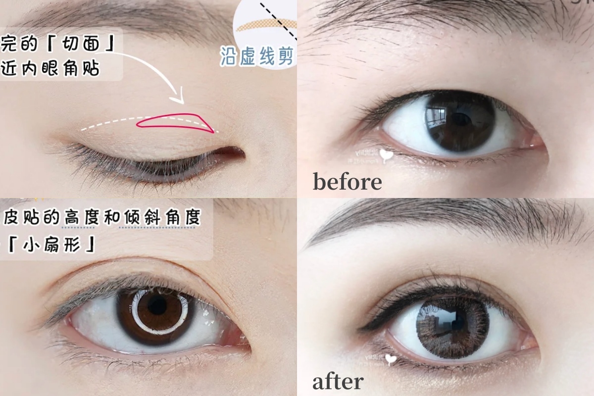 單眼皮的女生應該挑選新月形的雙眼皮貼