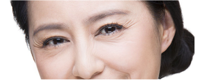 額頭紋、法令紋、魚尾紋都是真皺紋。