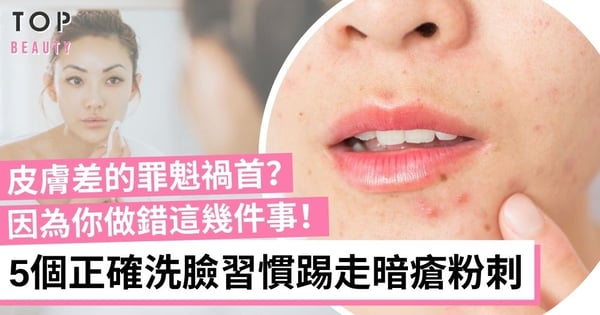 明明做好清潔仍不斷爆瘡？養成5個良好生活習慣 洗臉前務必先洗手！