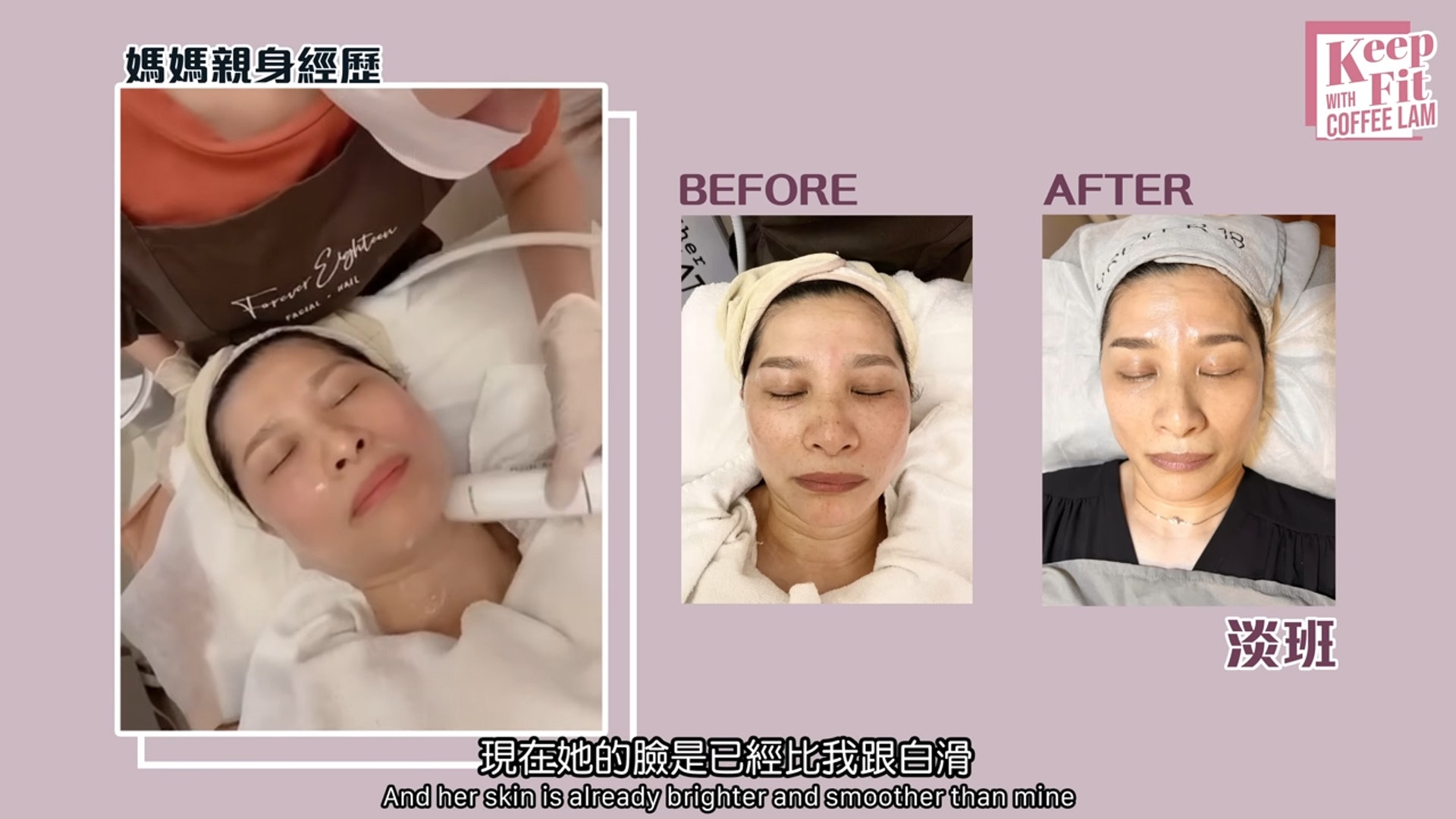 Coffee林芊妤帶媽媽去做Facial，主要針對去皺紋、打斑和回復彈性。