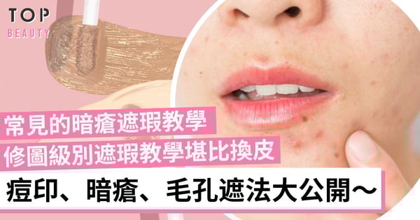 不同暗瘡種類遮瑕方法大不同!正確暗瘡遮瑕順序 立體暗瘡也能被磨平!