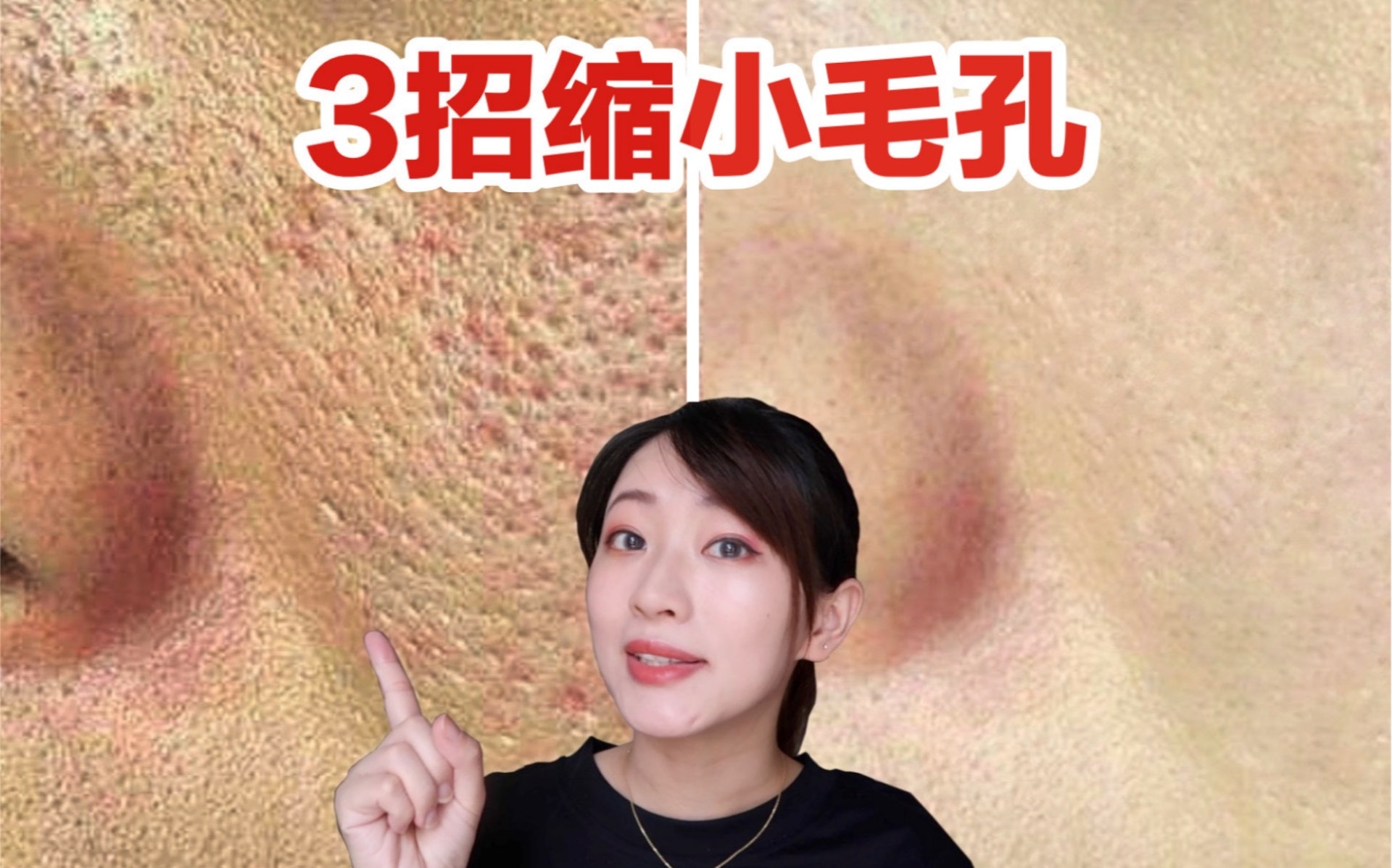 孔會熱脹冷縮,可使用高濃度的「純維他命C」精華,有效修復毛孔。