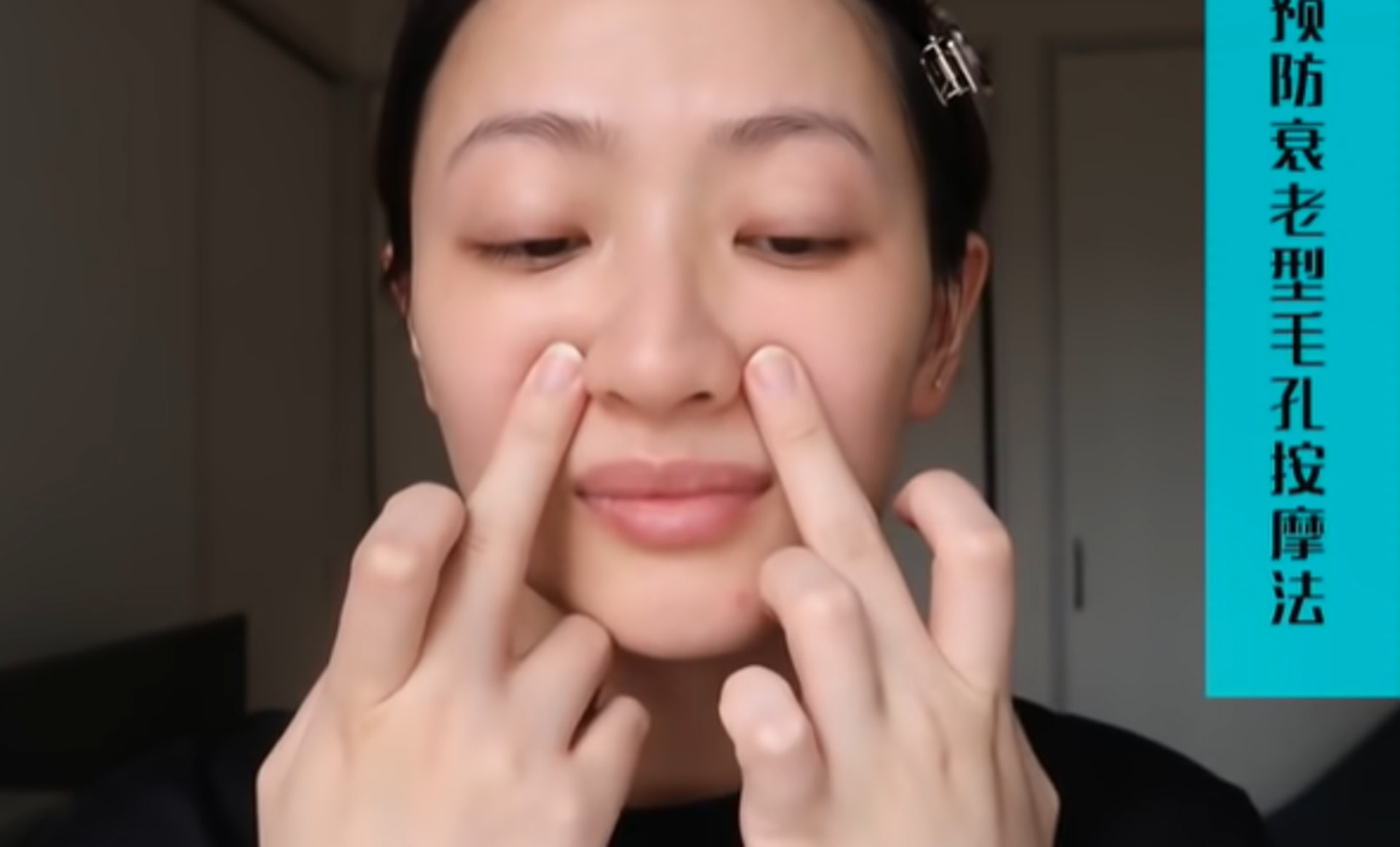 珠型毛孔通常會發生在全臉,是一和較難搞的膚況問題,這類人士防止過度塗抹乳液及面霜。
