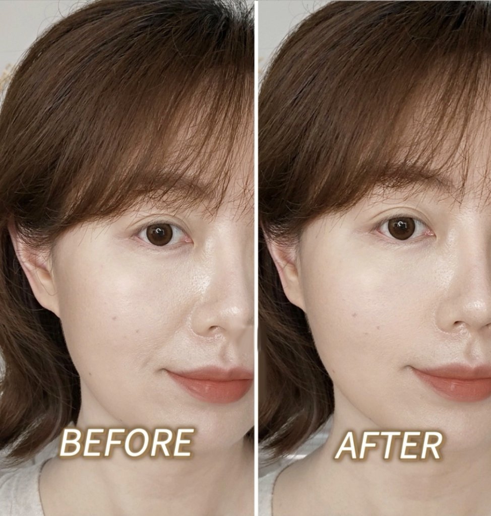 隱藏法令紋前後對比。