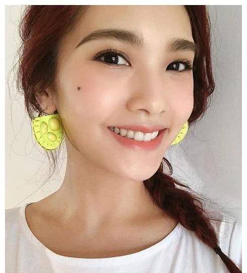 許多女明星是因為臉上有痣才更顯獨特