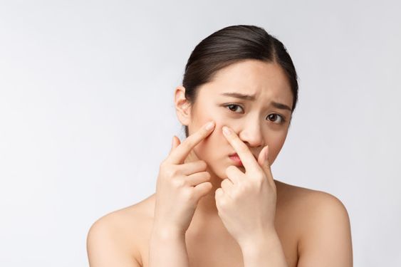 臉上出現討厭的暗瘡，相信是不少女人最痛恨的皮膚問