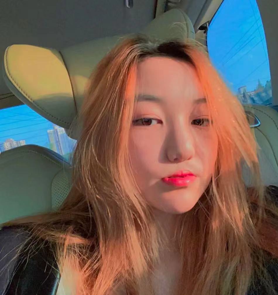 李嫣並沒有因為天生患有兔唇而感到自卑,反而充滿自信。