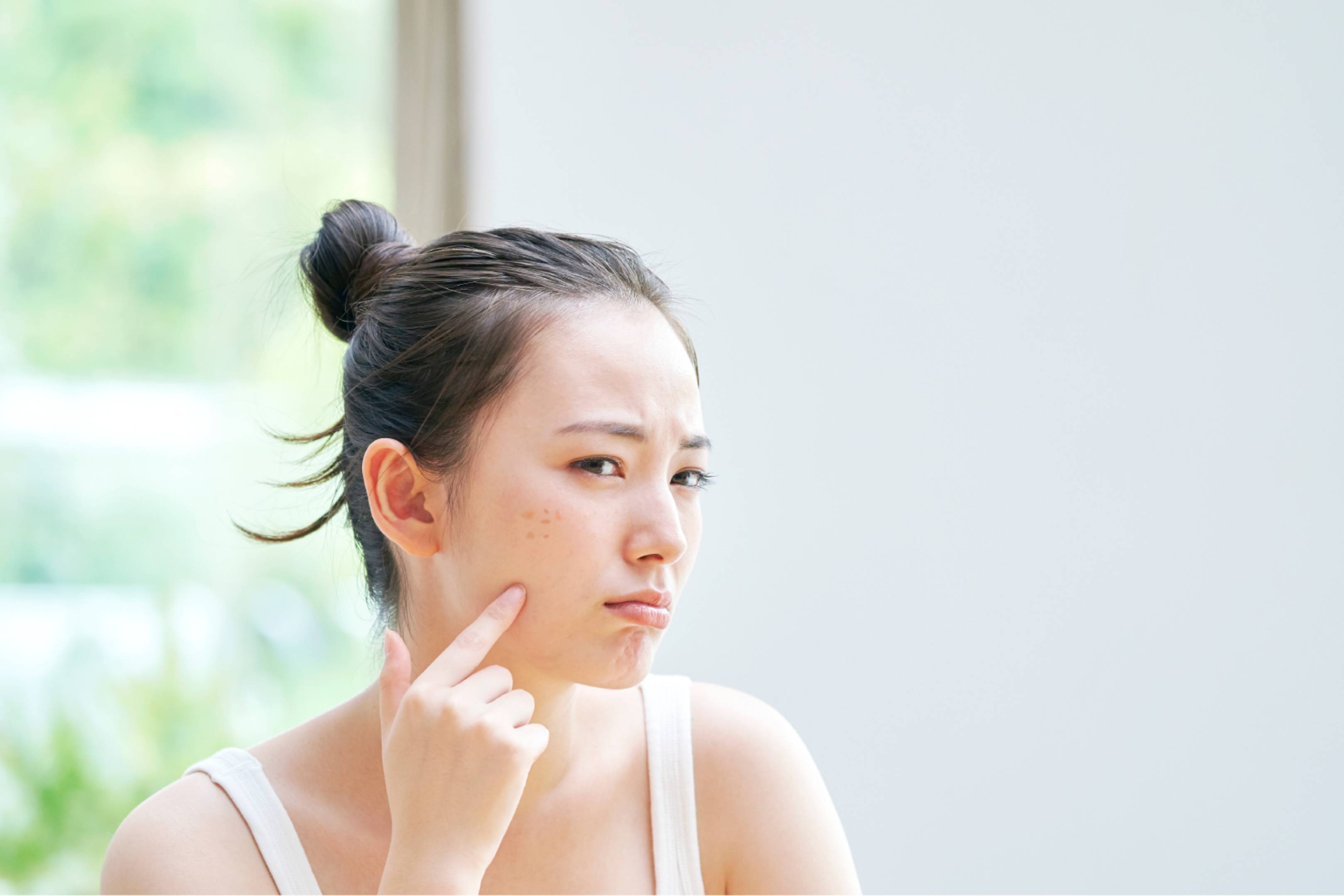 色斑是美編覺得最難「搞掂」的肌膚瑕疵之一!