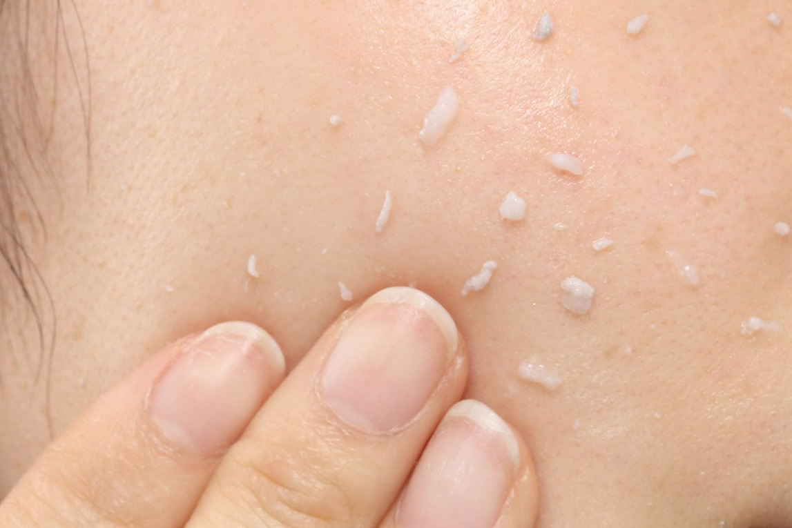 這些看似擦膠碎的物體其實是護膚品的「高分子膠」所導致