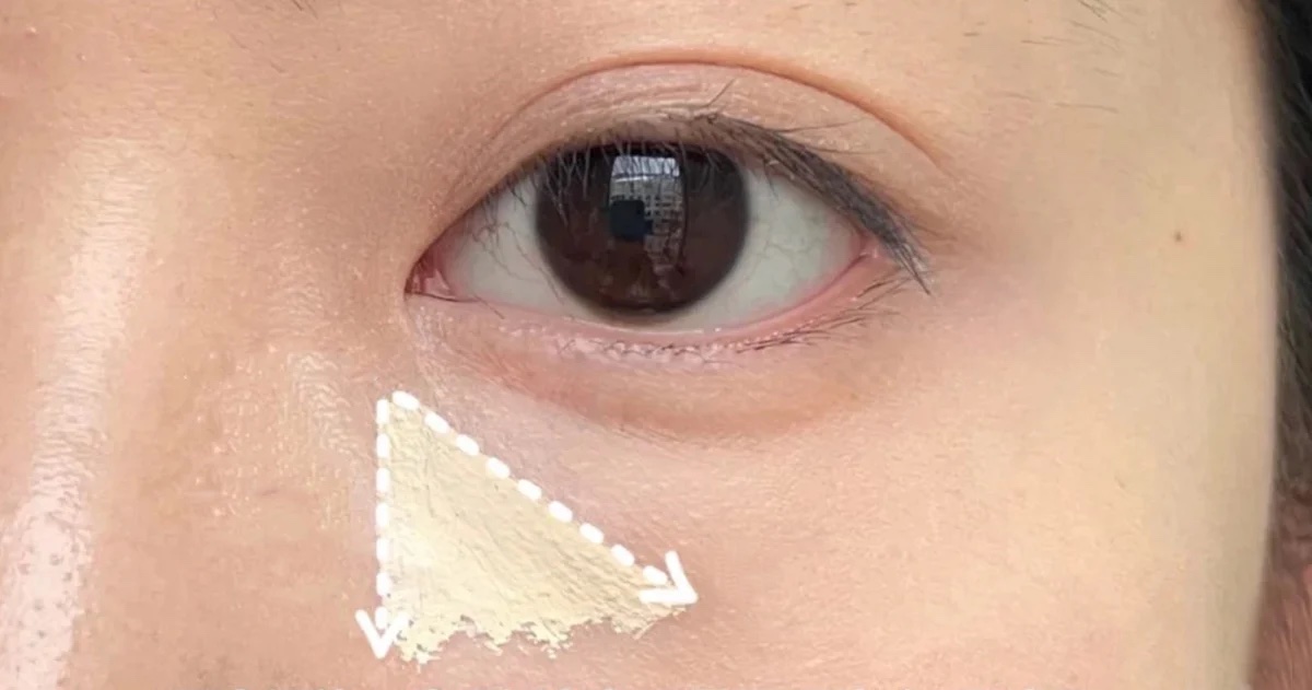 步驟二：淚溝三角形