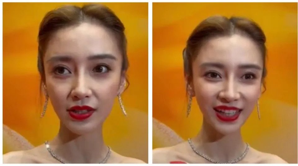 Angelababy零濾鏡之下膚色暗啞、額頭長滿痘痘,臉上的法令紋相當明顯,還有又黑又大的眼袋,顏值大跌watt。