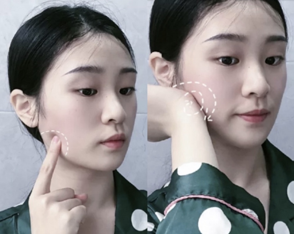 三、消滅咀嚼肌