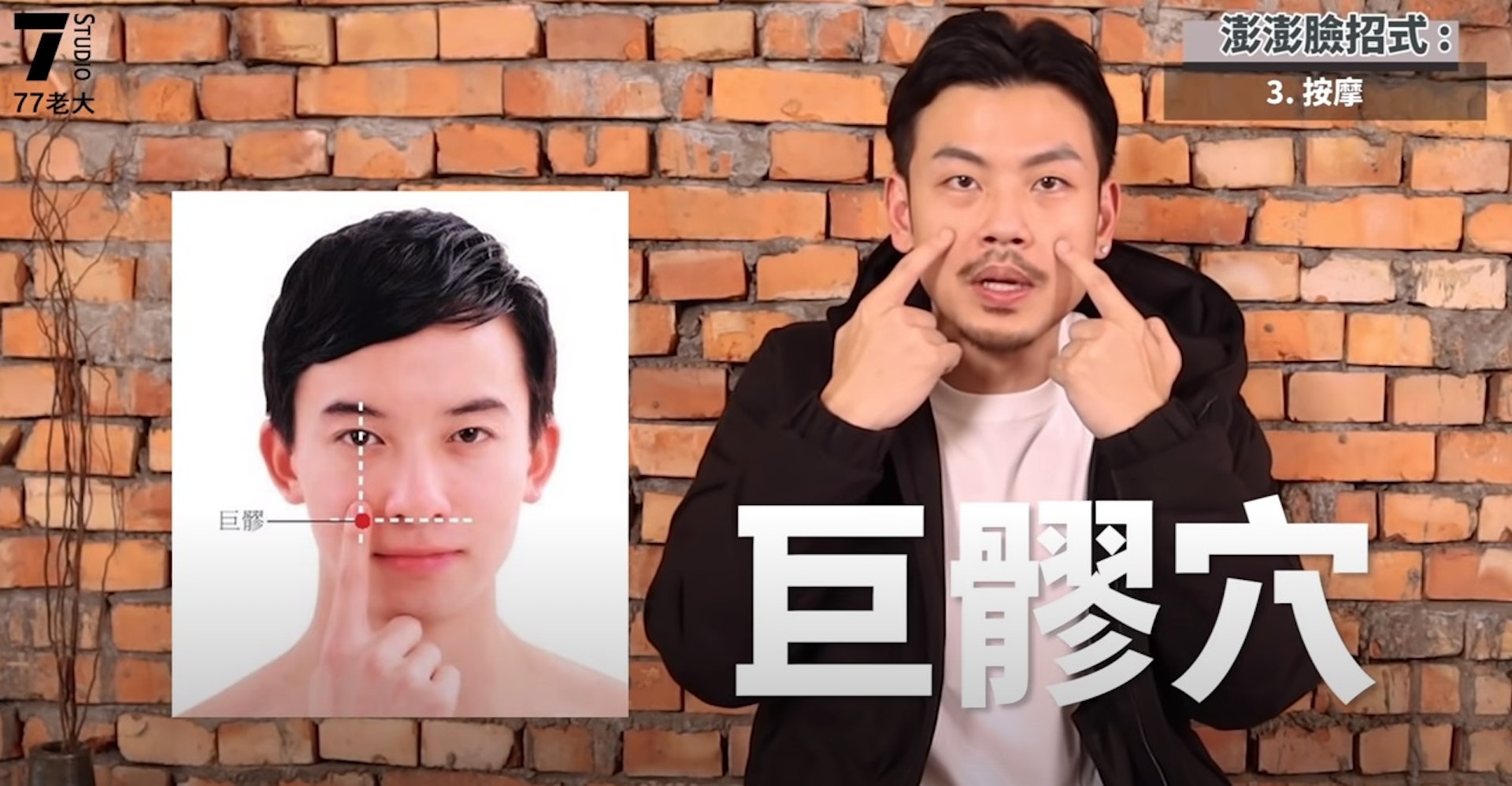巨髎穴是鼻翼及瞳孔交接位置。