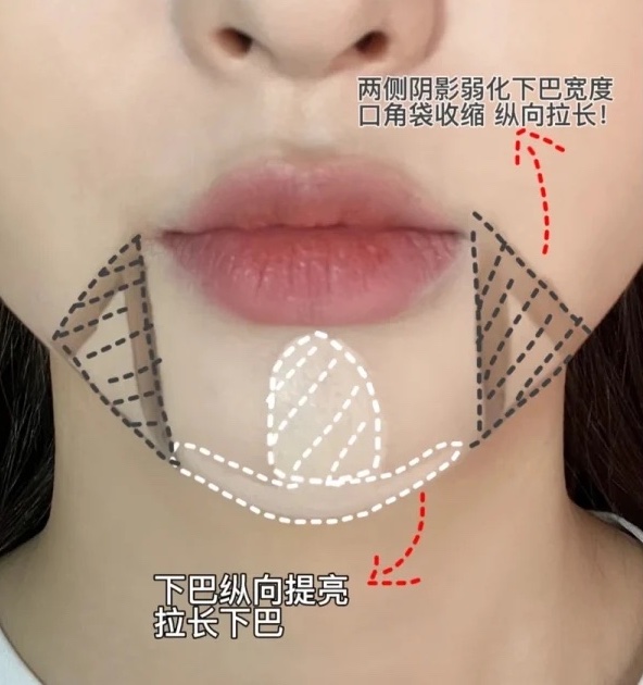下巴修容術四、短下巴變長