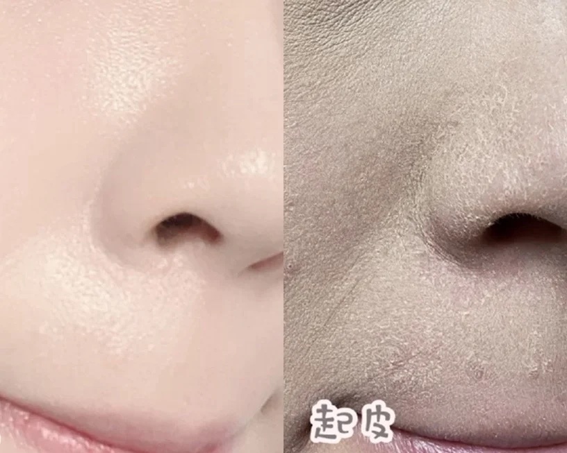 來到冬天,面對愈來愈乾燥的天氣,皮膚容易出現出油、脫妝的情況