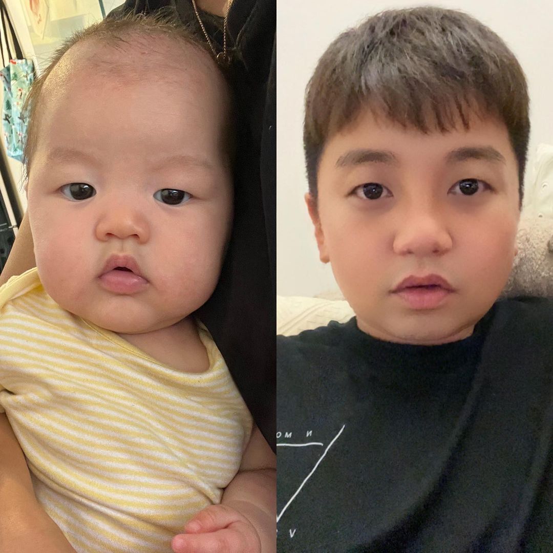 現時1歲的Amber與遺傳爸爸基因