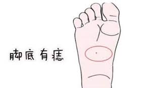痣應該長在不容易被看見的地方,長在腳底的話更是「好中之好」