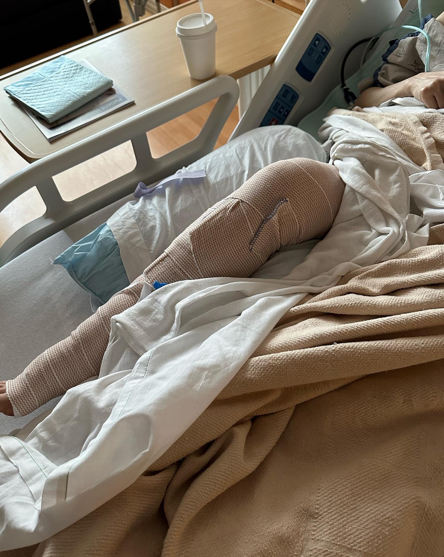 劉美君右腳脛骨骨折要接受手術