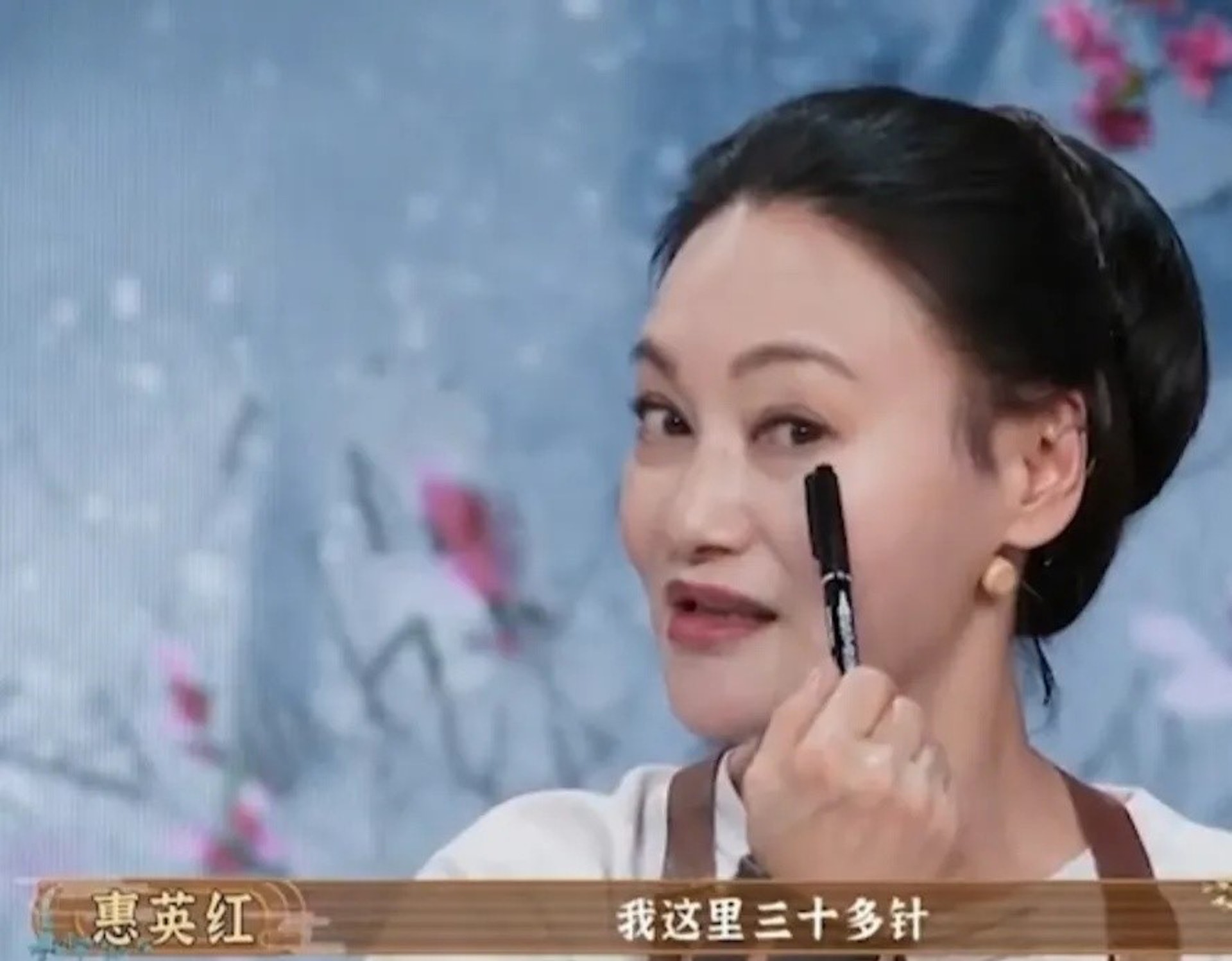 眼睛下面有縫過針。