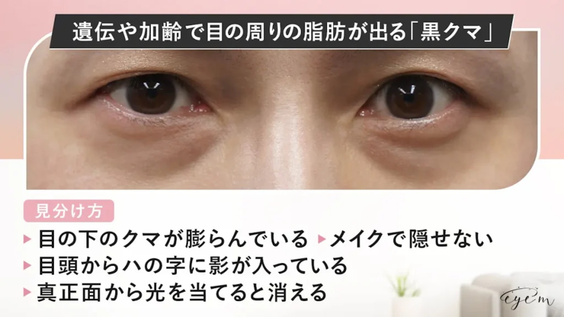 「黑」眼圈。