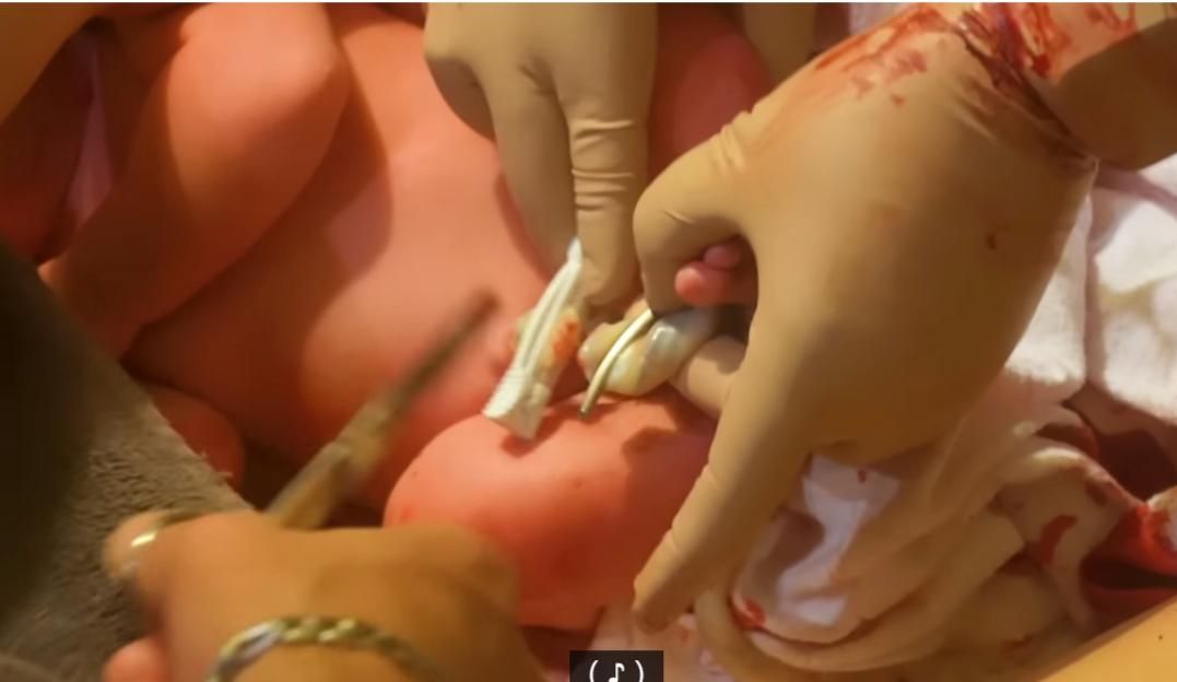 同時畫面亦收錄了剪臍帶的一幕，十分珍貴。