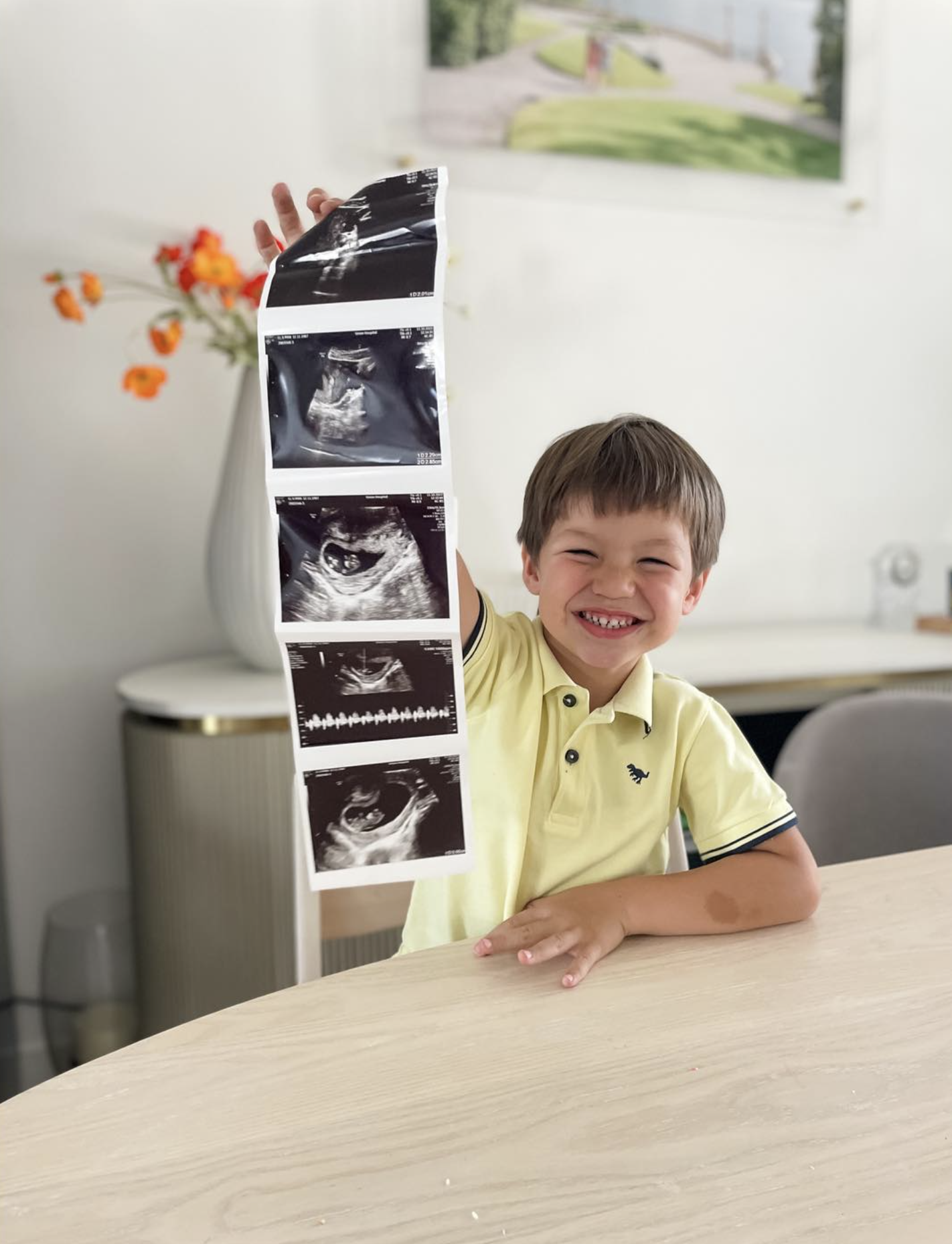 李姿敏2018年誕下混血兒子賀朗琋