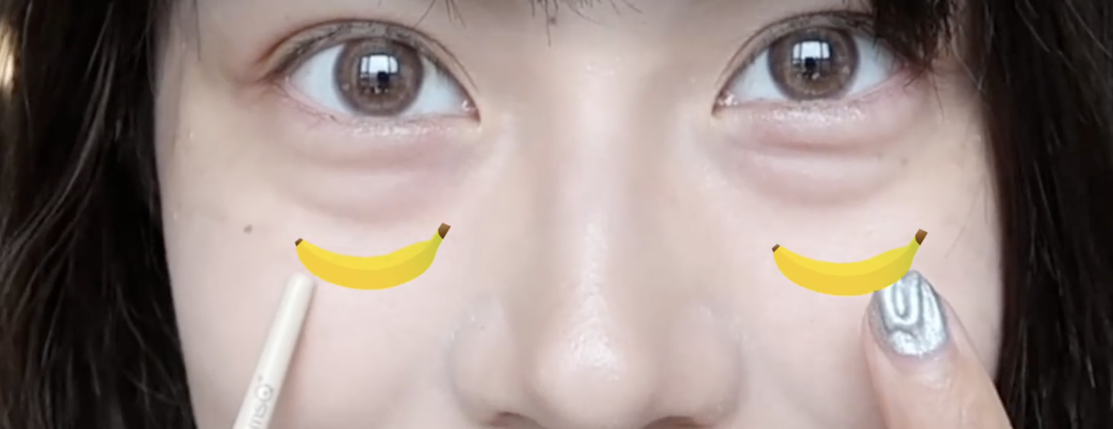 可見內眼角開始黑色圍成一圈