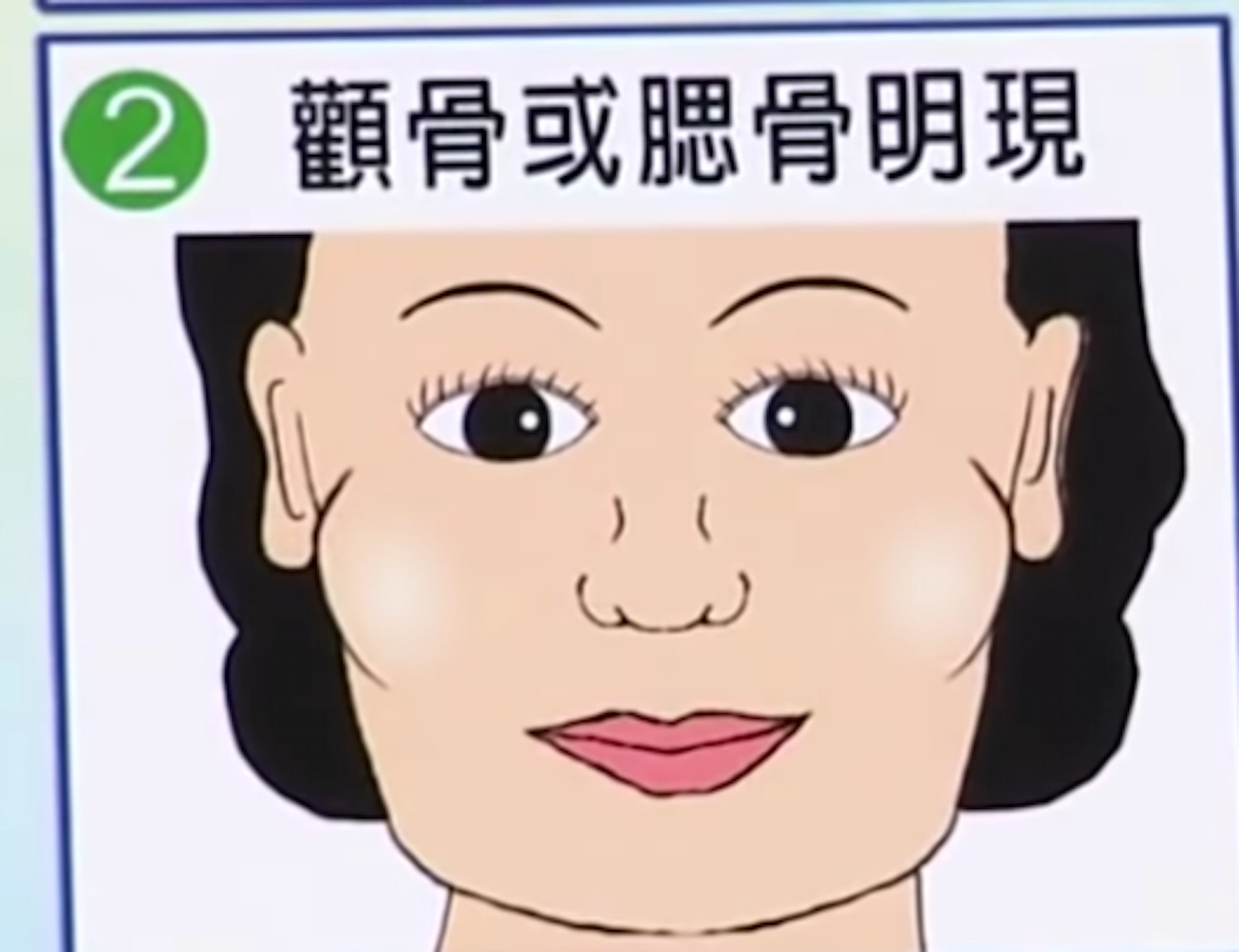 顴骨或腮骨明顯。
