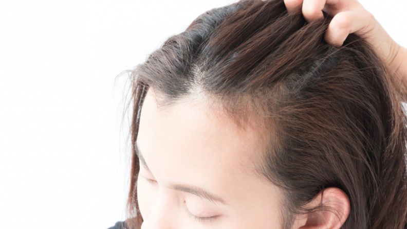 脫髮原因：頭皮缺乏保養