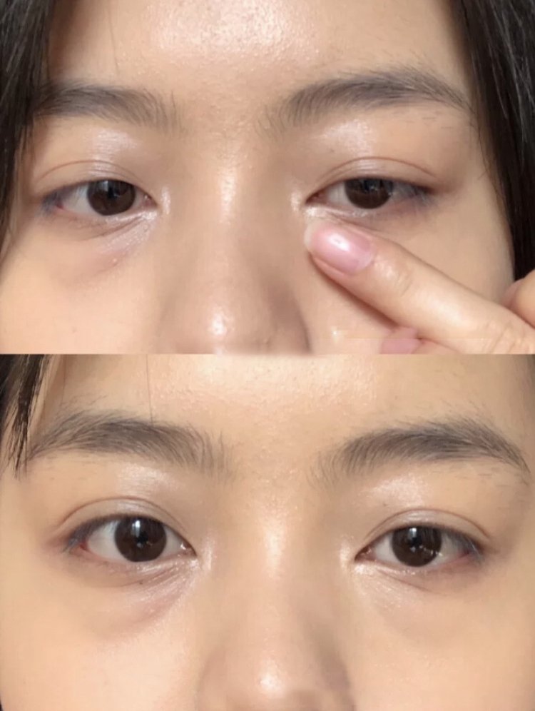 校正黑眼圈顏色。