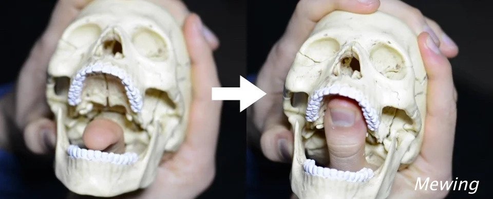 英國牙醫Dr. Mew所推行的口腔運動「Mewing」,可以透過舌頭自我矯正。