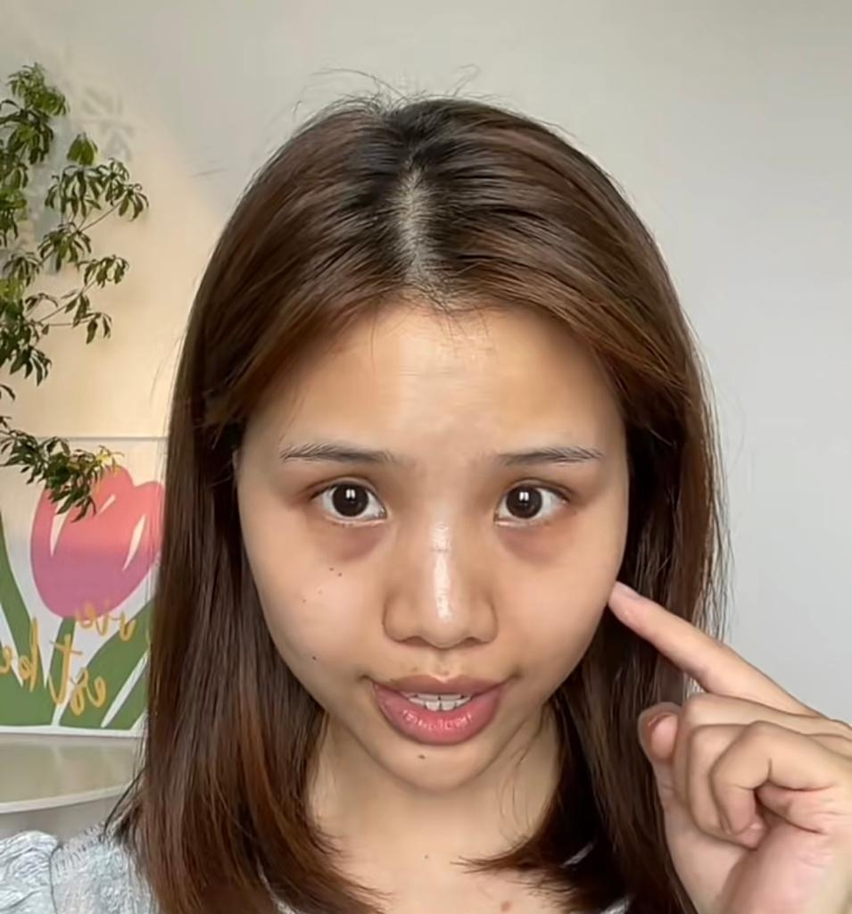 先低頭，可以清楚看到淚溝、黑眼圈位置。