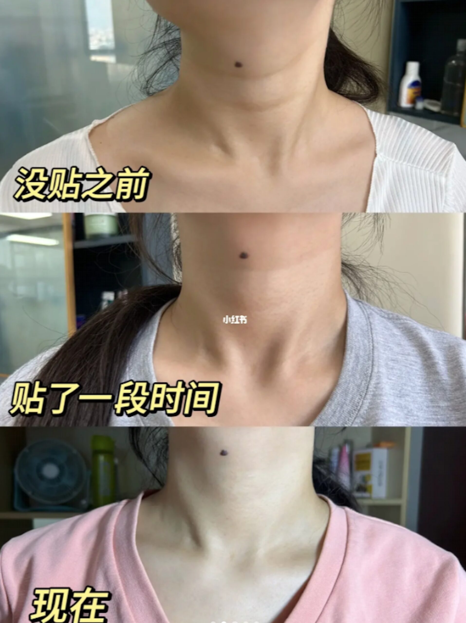 網民實測消滅頸紋大法。