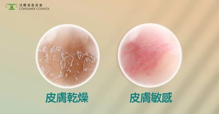 消委會測試，9款爽膚水過度使用會傷害皮膚。