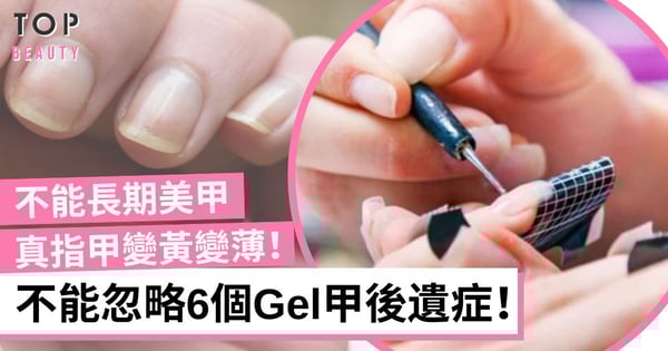 6個Gel甲後遺症 長期美甲會導致真指甲變黃變薄 這樣做能預防指甲變黃