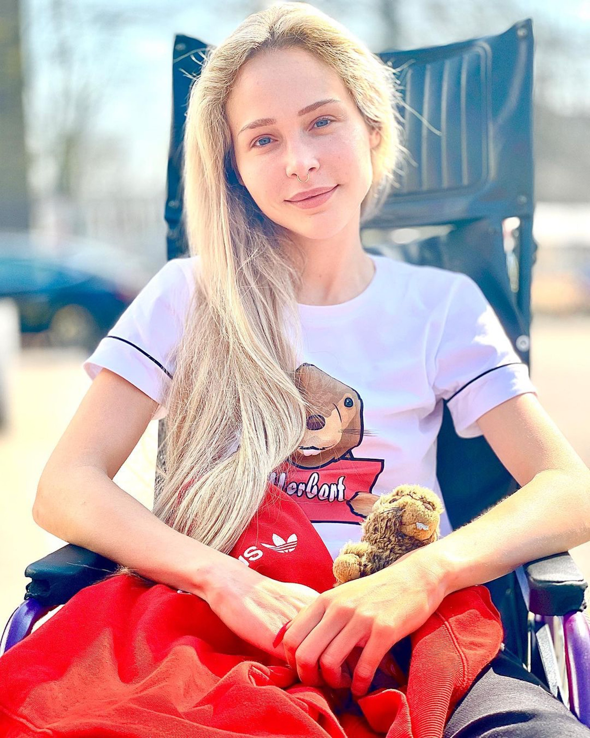 做完增高手術後，過著很長的一段時間坐輪椅。